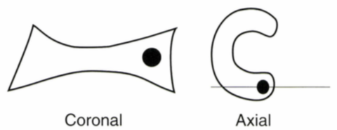 coronal axial