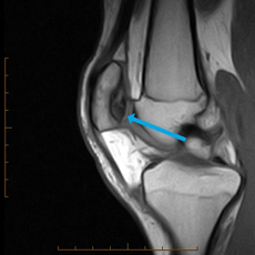 sagittal t1