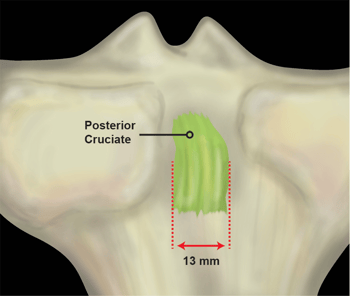 posterior cruciate