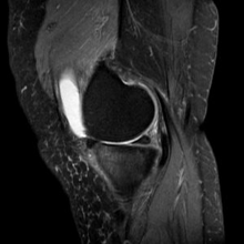 sagittal pd